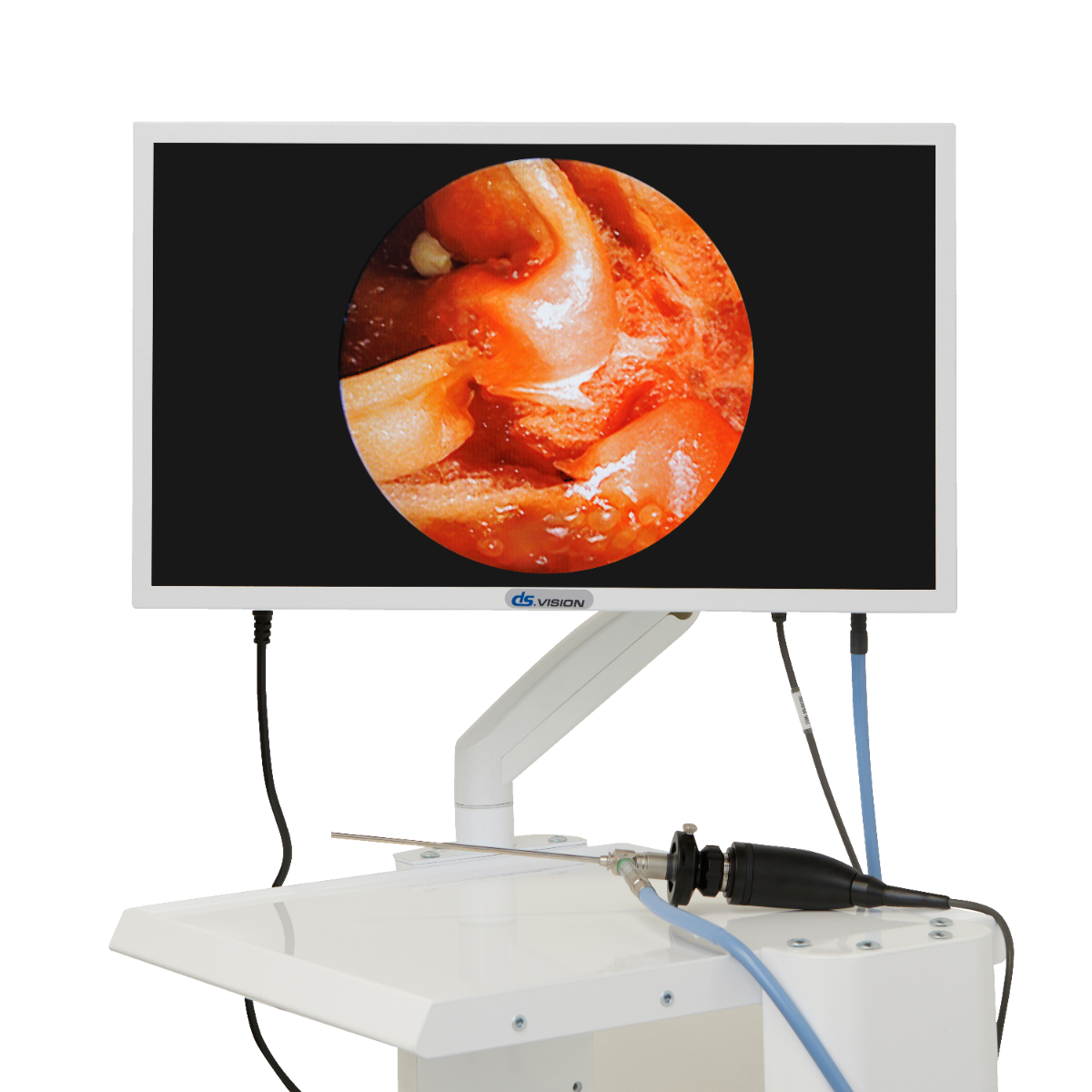 DS.Vision endoscopic video systems
